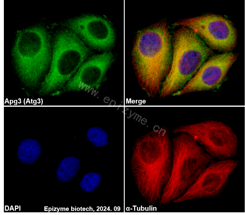 Anti-ATG3 Rabbit mAb [98P21J87]