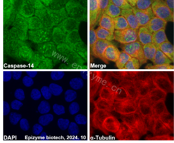 Anti-Caspase-14 Rabbit mAb [98H72Q31]