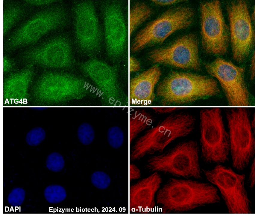 Anti-ATG4B Rabbit mAb [25O16T81]