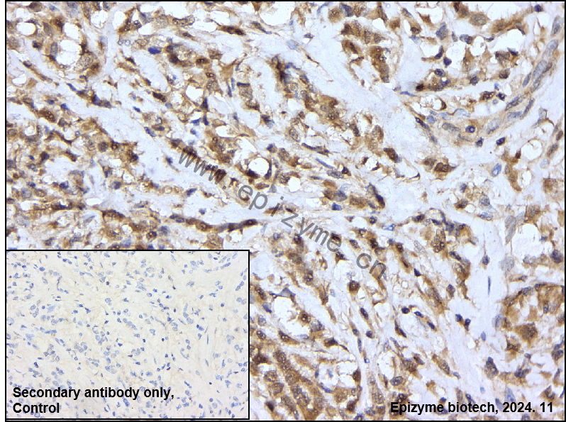 Anti-ATG4B Rabbit mAb [25O16T81]