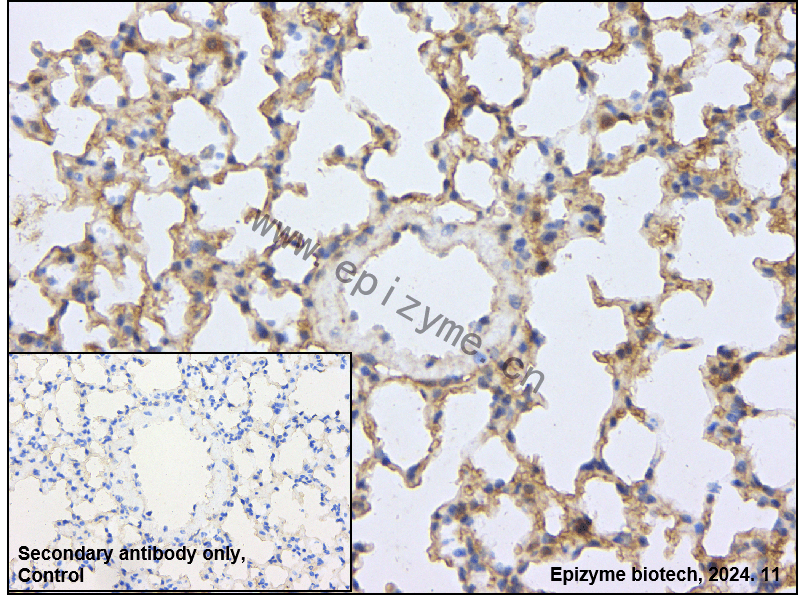 Anti-ATG4B Rabbit mAb [25O16T81]