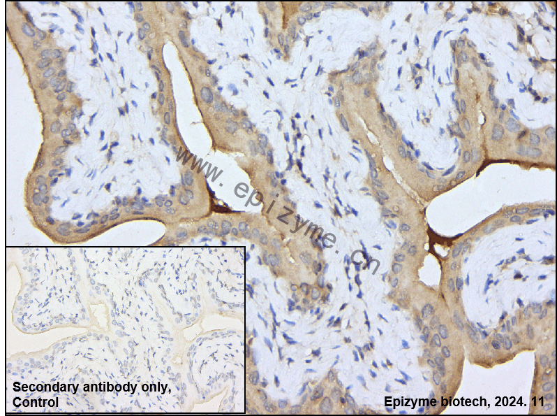 Anti-ATG4B Rabbit mAb [25O16T81]