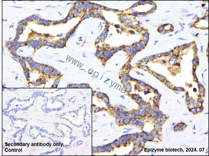 Anti-ATG4C Rabbit mAb [87R86G27]