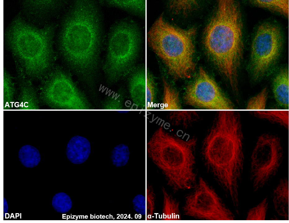 Anti-ATG4C Rabbit mAb [87R86G27]