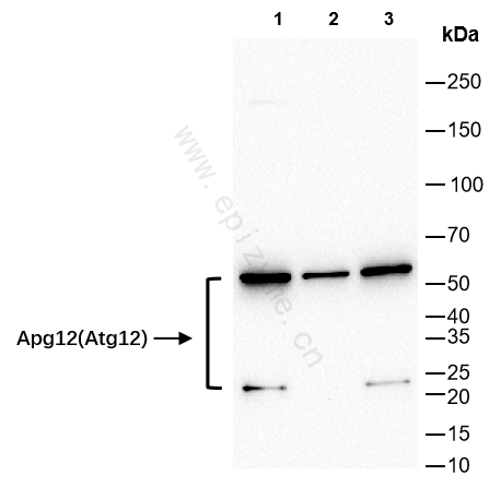 Anti-ATG12 Rabbit mAb [51H32K65]
