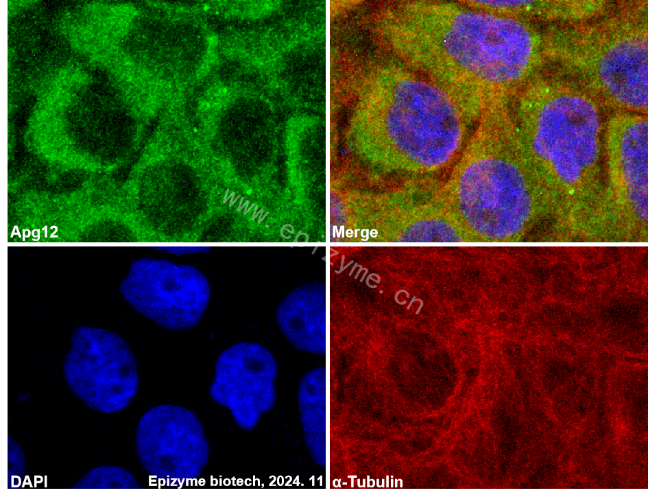Anti-ATG12 Rabbit mAb [51H32K65]