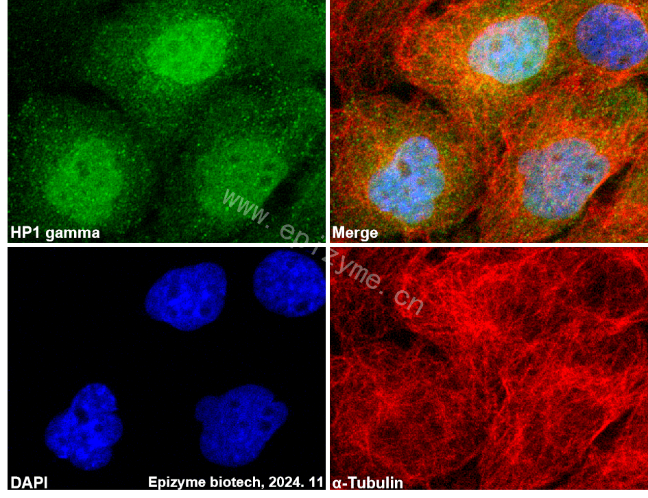 Anti-HP1 gamma/CBX3 Rabbit mAb [42E59A88]