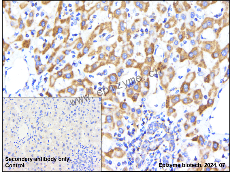 Anti-ATG4A Rabbit mAb [96N44G21]