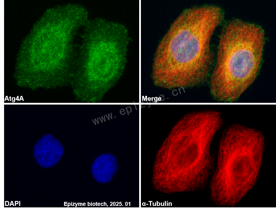 Anti-ATG4A Rabbit mAb [96N44G21]