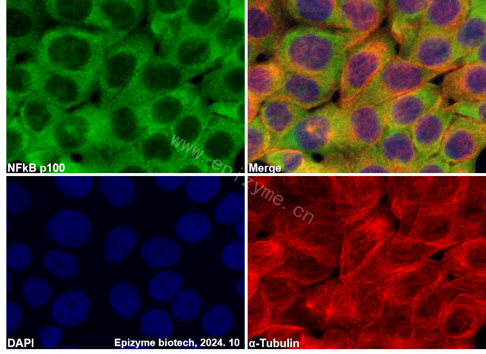 Anti-NFkB p100/NFKB2 Rabbit mAb [43I13E24]