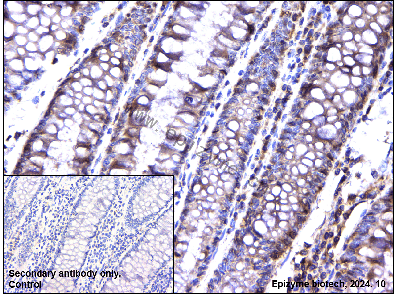 Anti-NFkB p100/NFKB2 Rabbit mAb [43I13E24]