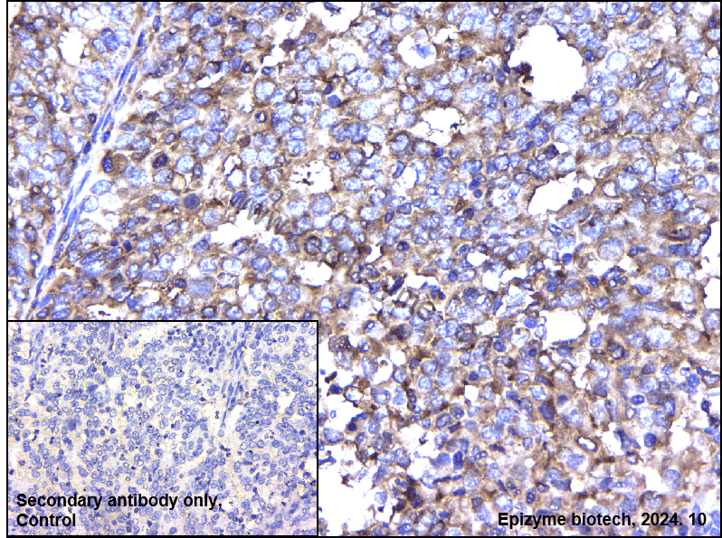 Anti-NFkB p100/NFKB2 Rabbit mAb [43I13E24]