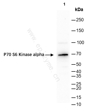 Anti-S6K1 Rabbit mAb [92F06J82]