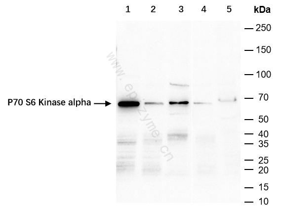 Anti-S6K1 Rabbit mAb [92F06J82]