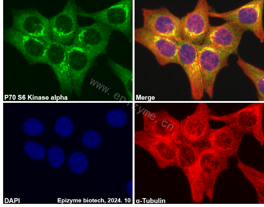 Anti-S6K1 Rabbit mAb [92F06J82]