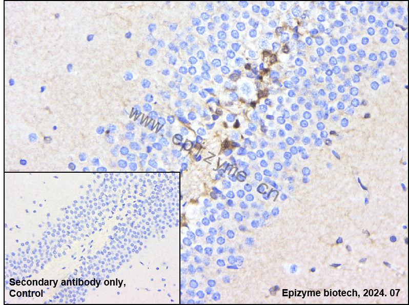 Anti-CDKN2C Rabbit mAb [70O86E69]