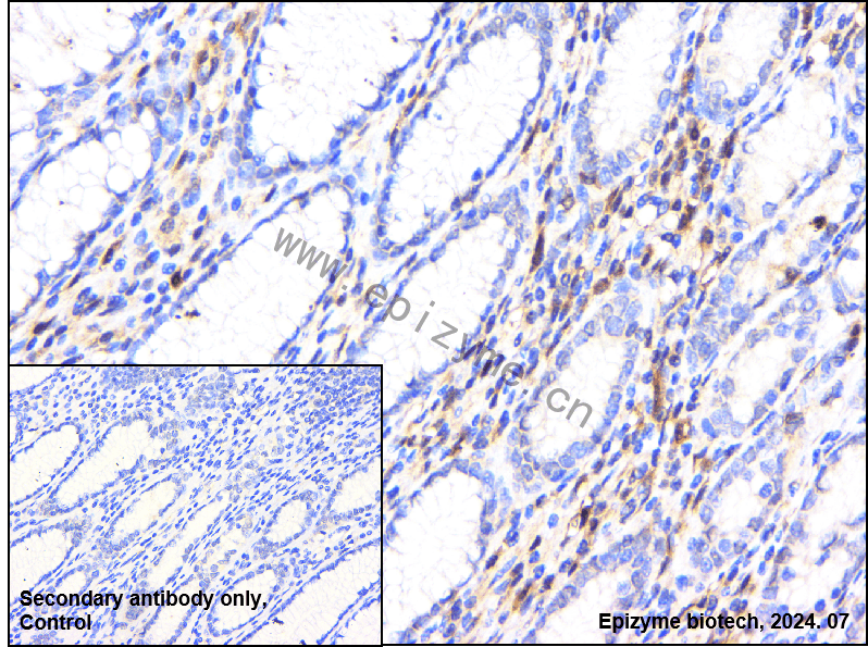 Anti-CDKN2C Rabbit mAb [70O86E69]