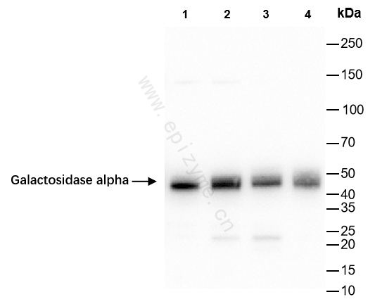 Anti-Galactosidase alpha Rabbit mAb [82B07B13]