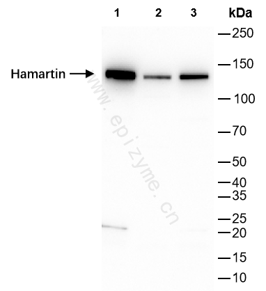 Anti-Hamartin Rabbit mAb [67K16J83]