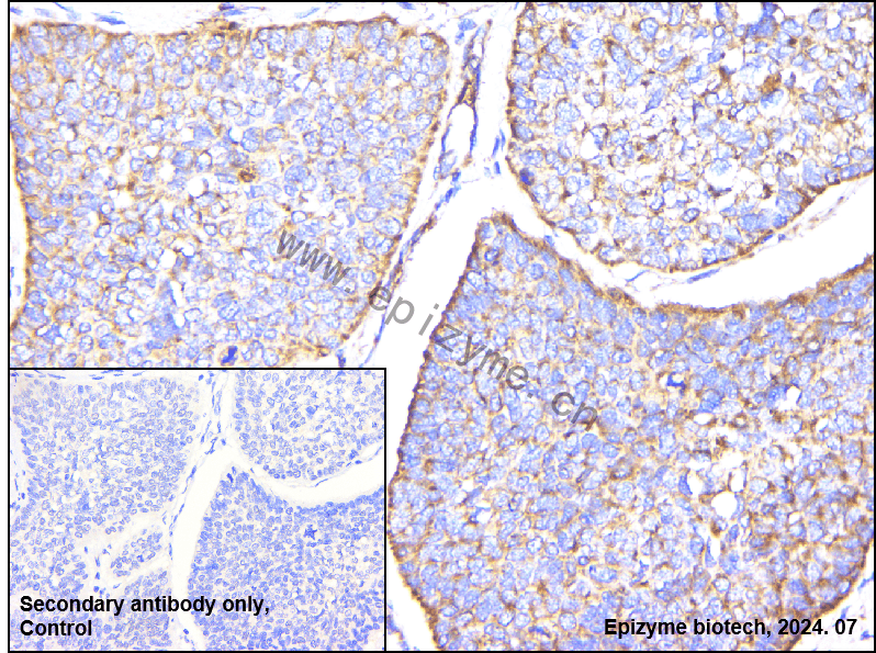 Anti-Hamartin Rabbit mAb [67K16J83]