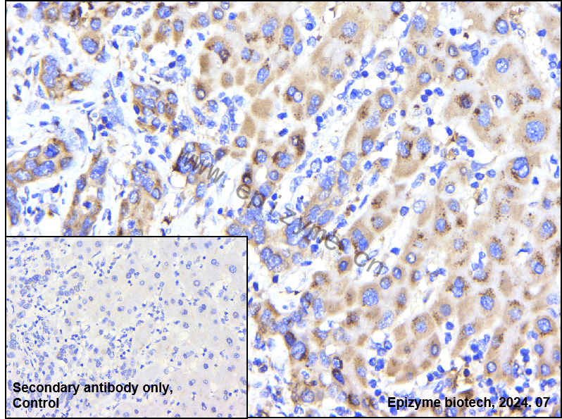 Anti-Hamartin Rabbit mAb [67K16J83]