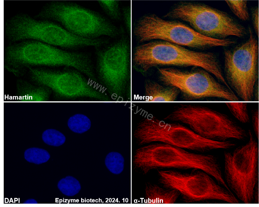 Anti-Hamartin Rabbit mAb [67K16J83]