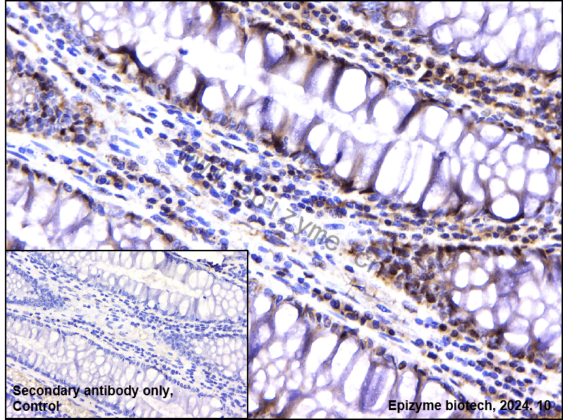 Anti-CAD Rabbit mAb [87L99Q21]