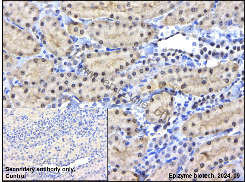 Anti-AATF Rabbit mAb [94J34P21]