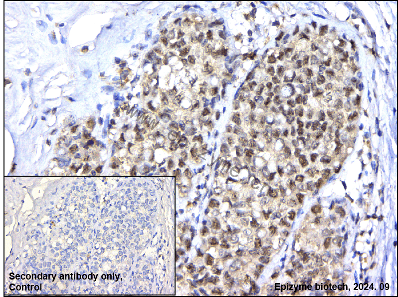 Anti-AATF Rabbit mAb [94J34P21]