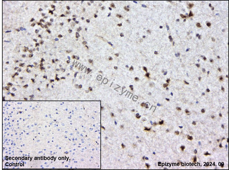 Anti-AATF Rabbit mAb [94J34P21]