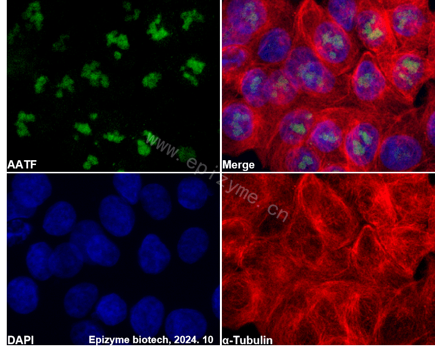 Anti-AATF Rabbit mAb [94J34P21]