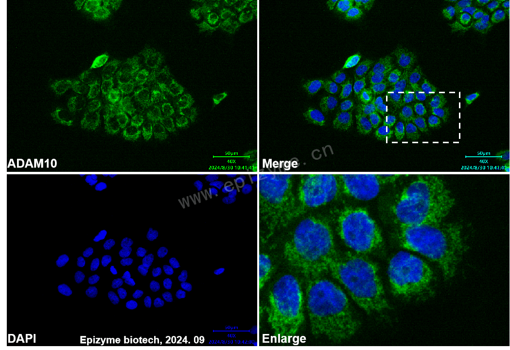 Anti-ADAM10 Rabbit mAb [76M63D54]