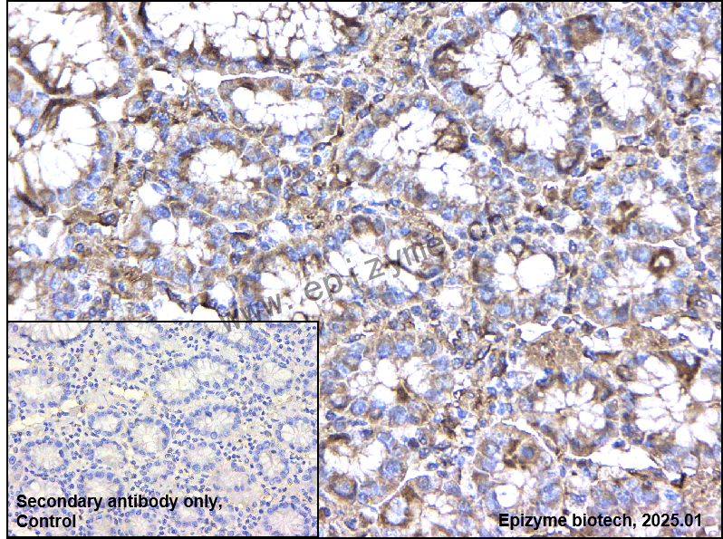 Anti-ADAM10 Rabbit mAb [76M63D54]