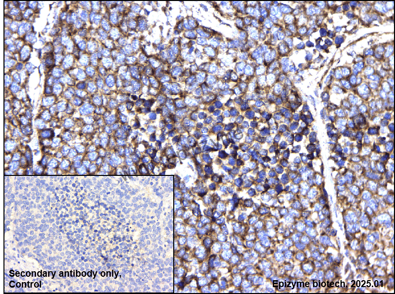 Anti-ADAM10 Rabbit mAb [76M63D54]