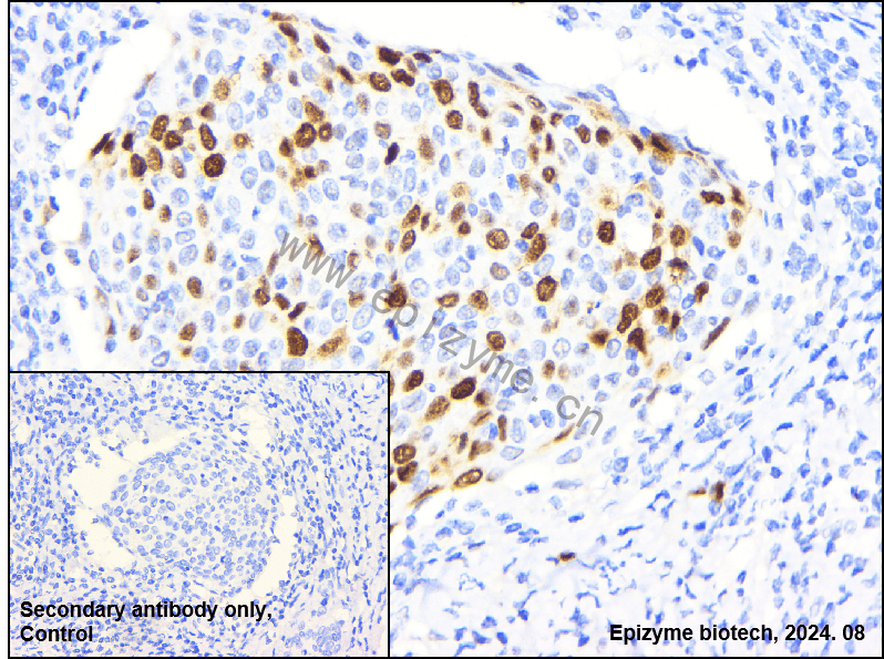 Anti-Cyclin A2 Rabbit mAb [90T34S42]