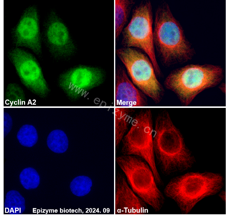 Anti-Cyclin A2 Rabbit mAb [90T34S42]