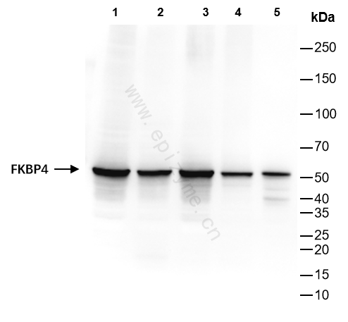Anti-FKBP52 Rabbit mAb [83Q32M45]