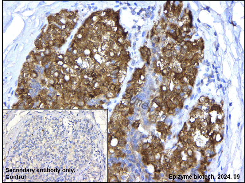 Anti-FKBP52 Rabbit mAb [83Q32M45]