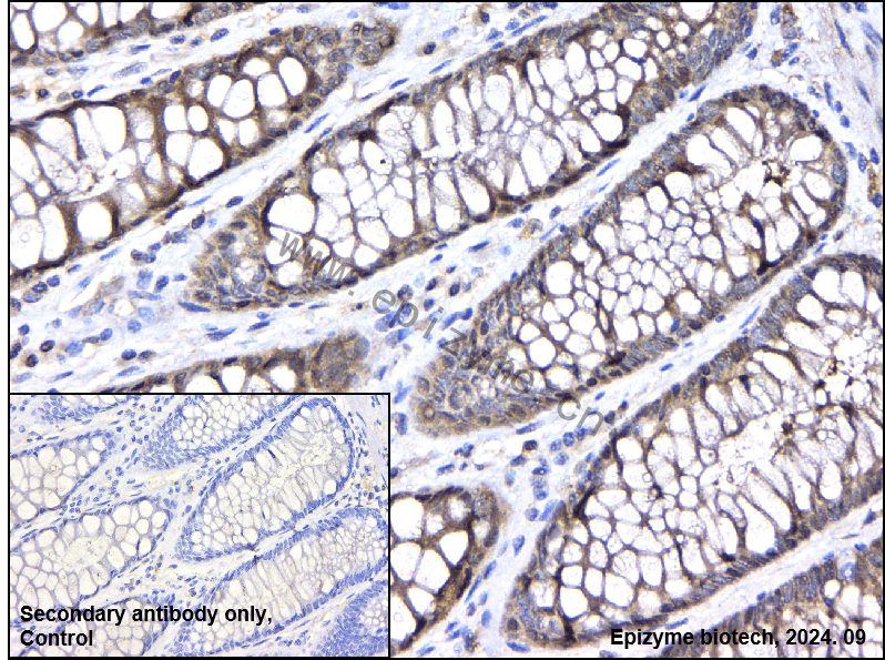 Anti-FKBP52 Rabbit mAb [83Q32M45]
