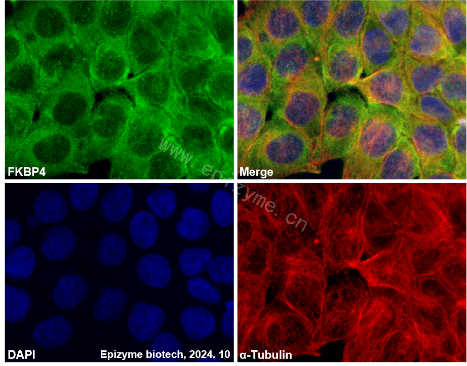Anti-FKBP52 Rabbit mAb [83Q32M45]