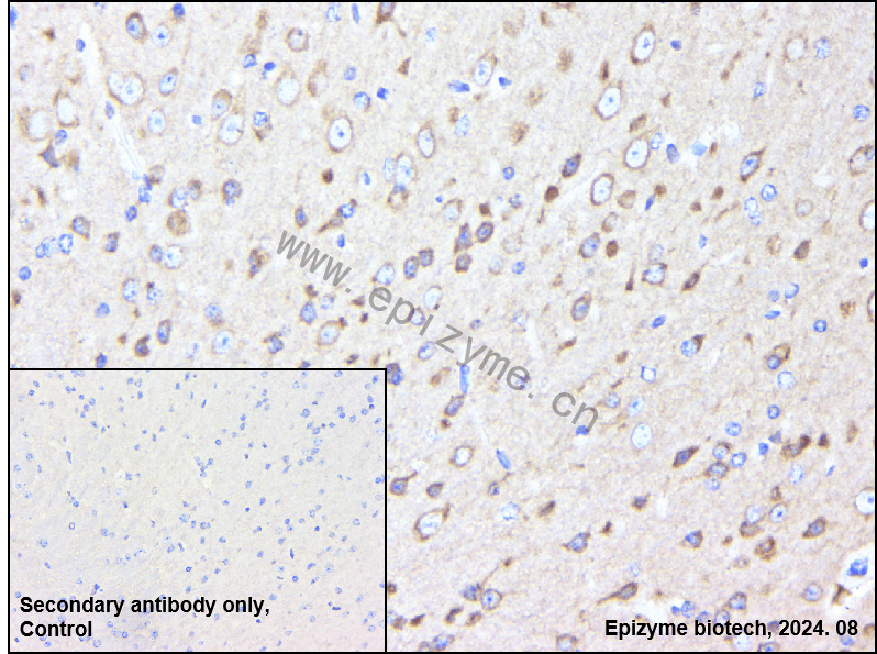Anti-Huntingtin Rabbit mAb [48H75B12]