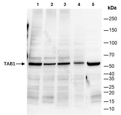Anti-TAB1 Rabbit mAb [49H14C57]
