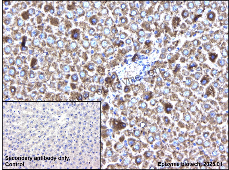 Anti-TAB1 Rabbit mAb [49H14C57]
