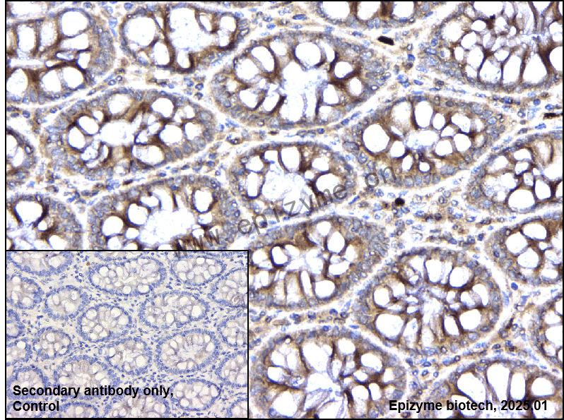 Anti-TAB1 Rabbit mAb [49H14C57]