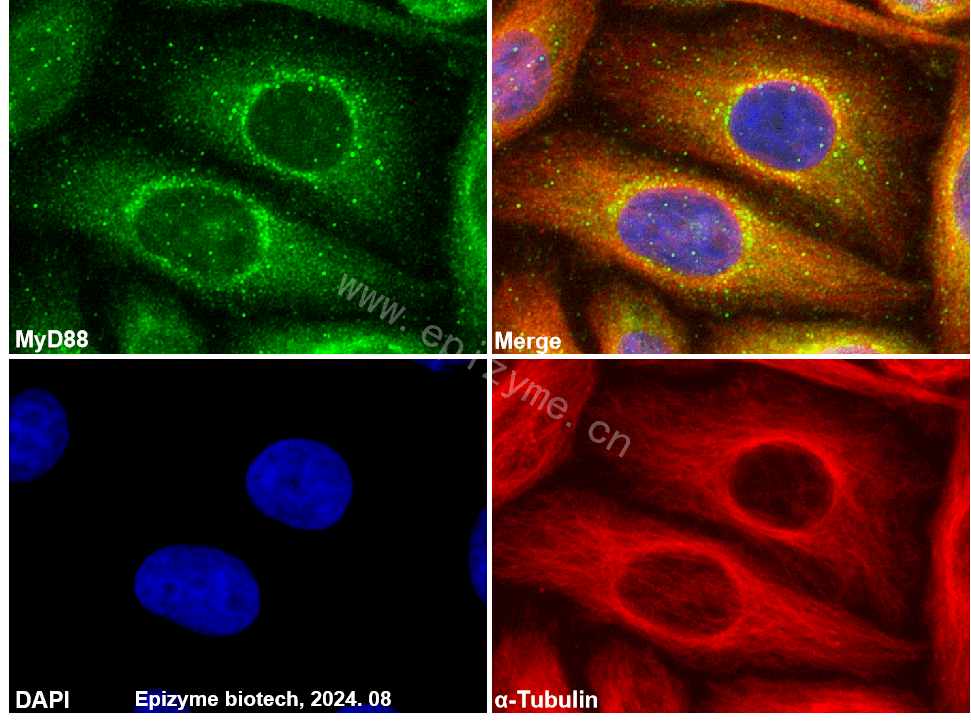 Anti-MyD88 Rabbit mAb [43Q70G58]