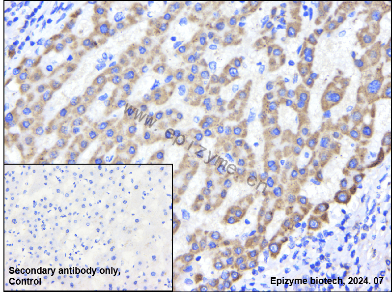 Anti-MyD88 Rabbit mAb [43Q70G58]