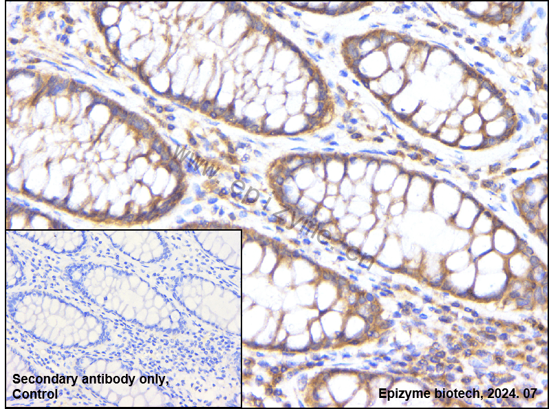 Anti-MyD88 Rabbit mAb [43Q70G58]