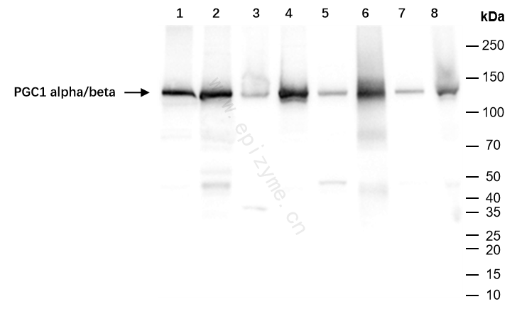 Anti-PGC1 alpha/beta Rabbit mAb [25M82C11]