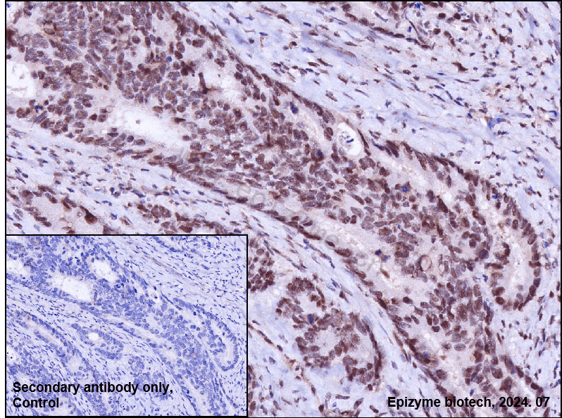 Anti-Phospho-ATM (Ser1981) Rabbit mAb [79T70I07]