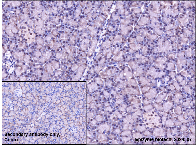 Anti-Phospho-ATM (Ser1981) Rabbit mAb [79T70I07]